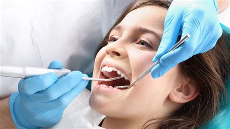 profilaxia dental - caries dental